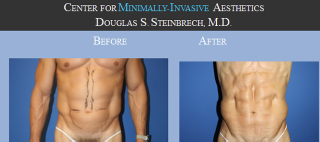 Illustration for article titled The Manly World of Manly Plastic Surgery for Manly Men